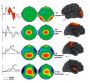 HBIMed Brain Indexes Database