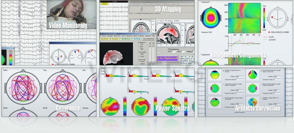 Your One Stop Shop for Leading Edge Brain Diagnostic Equipment, Training & Assessment
