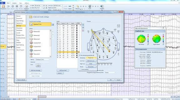 See Our Popular TGA Approved EEG Amplifier